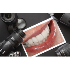 Dental Photo Set – Camera & Ring Light