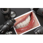 Dental Photo Set – Camera & Ring Light